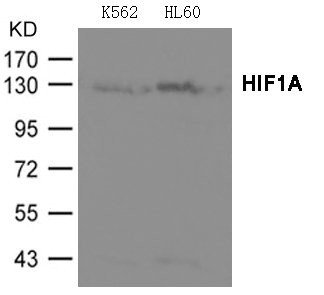 Anti-HIF1A