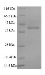 Hyaluronan synthase 2 (Has2), partial, mouse, recombinant