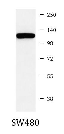 Anti-NTR3 / Sortilin