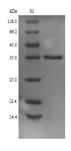 Monoglyceride lipase (Mgll), mouse, recombinant