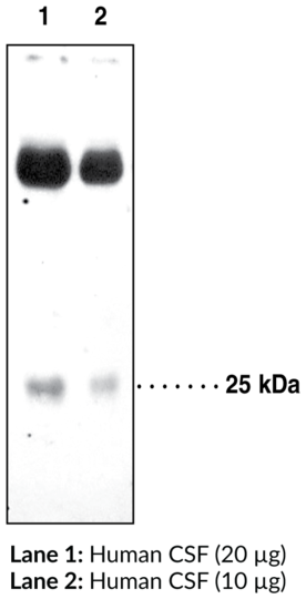 Anti-Prostaglandin D Synthase (lipocalin-type)