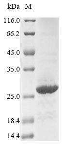 Neuronal acetylcholine receptor subunit alpha-3 (CHRNA3), partial, human, recombinant