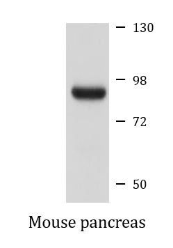 Anti-Methylmalonyl-CoA mutase