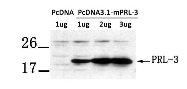 Anti-PTP4A3