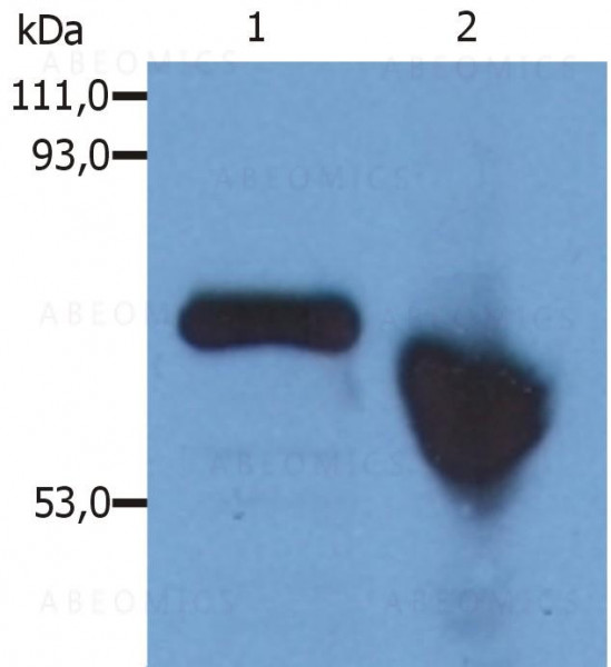 Anti-alpha-Fetoprotein Monoclonal Antibody (Clone:AFP-01)