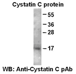 Anti-Cystatin C