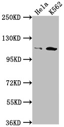 Anti-PIK3CB Recombinant Monoclonal, clone 5A9