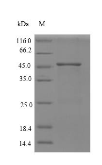 Replication protein A 32KDA subunit (RPA2), partial, human, recombinant