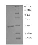 Histone deacetylase 9 (HDAC9), partial, human, recombinant