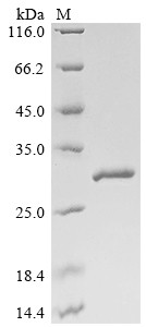 Glutathione S-transferase Mu 1 (Gstm1), partial, mouse, recombinant