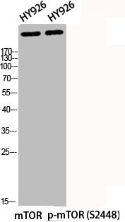 Anti-Phospho-MTOR (S2448)