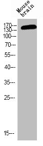 Anti-Phospho-GRIN2B (Y1474)