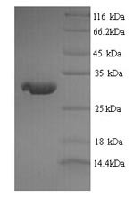 Major prion protein (Prnp), rat, recombinant