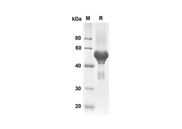 CA9 Protein (His Tag) (recombinant human)