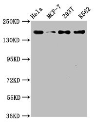 Anti-HDAC9 Recombinant Monoclonal, clone 1F2