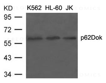 Anti-p62Dok (Ab-398)