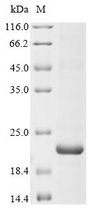 Sodium channel protein type 1 subunit alpha (SCN1A), partial, human, recombinant