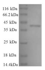 L-lactate dehydrogenase A chain (LDHA), partial, human, recombinant