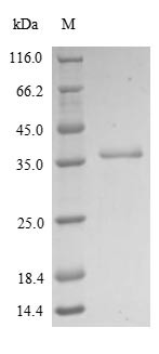 Metallothionein-2 (MT2A), partial, human, recombinant