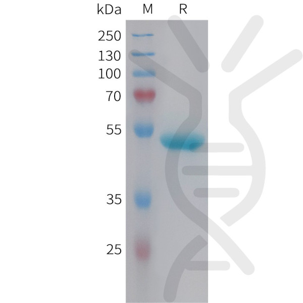 Human NGAL Protein, hFc Tag