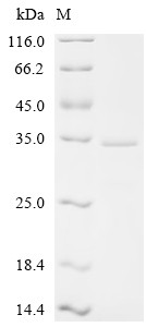 Appetite-regulating hormone (GHRL), Partial, human, recombinant