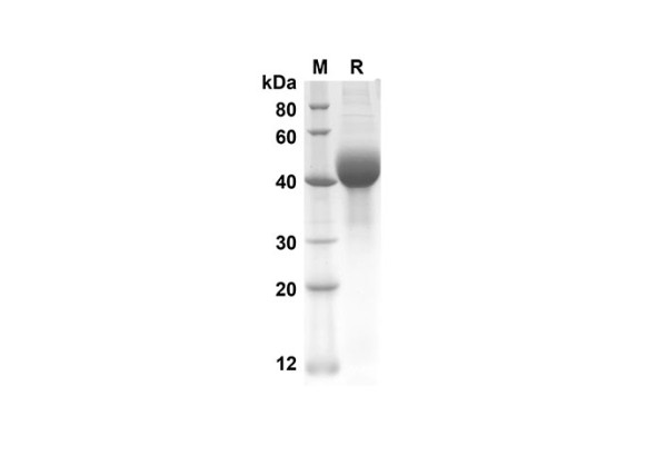 SP-D Protein (His Tag) (recombinant mouse)