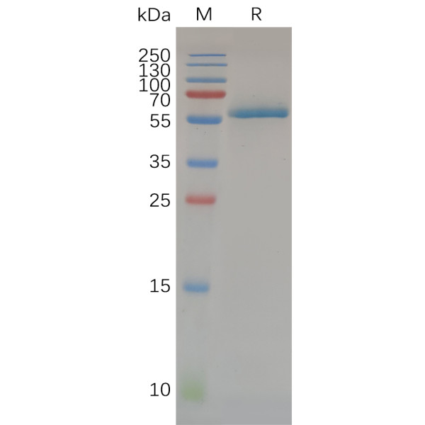 Human CD32A (H167) Protein, hFc Tag