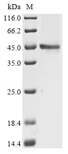 Actin, alpha skeletal muscle (ACTA1), human, recombinant