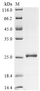 Interleukin-21 (IL21), partial, human, recombinant