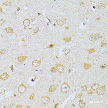 Anti-CHRNA7