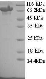 Toll-like receptor 8 (TLR8), partial, human, recombinant