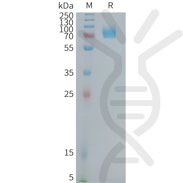 Human CD22(417-678) Protein, hFc Tag