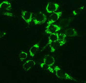 Anti-Argininosuccinate Lyase