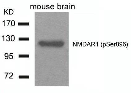 Anti-Phospho-GRIN1 (Ser896)