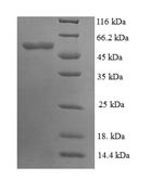 Pyruvate carboxylase 1 (PYC1), partial, Saccharomyces cerevisiae, recombinant