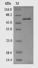 Acetyl-CoA carboxylase 1 (Acaca), partial, rat, recombinant