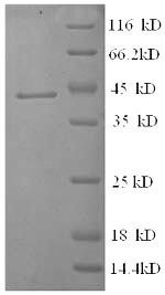 Corticosteroid-binding globulin (SERPINA6), human, recombinant