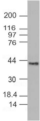 Anti-PINK1 (Clone: ABM5D85)