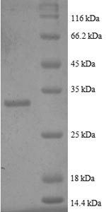 Metallothionein-2 (MT2A), partial, human, recombinant