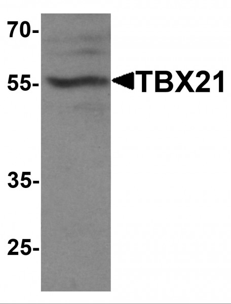 Anti-TBX21 / T-bet
