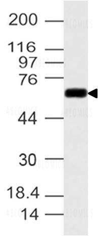 Anti-CYP1B1