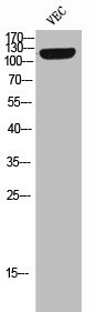 Anti-Phospho-TEK (Y992)