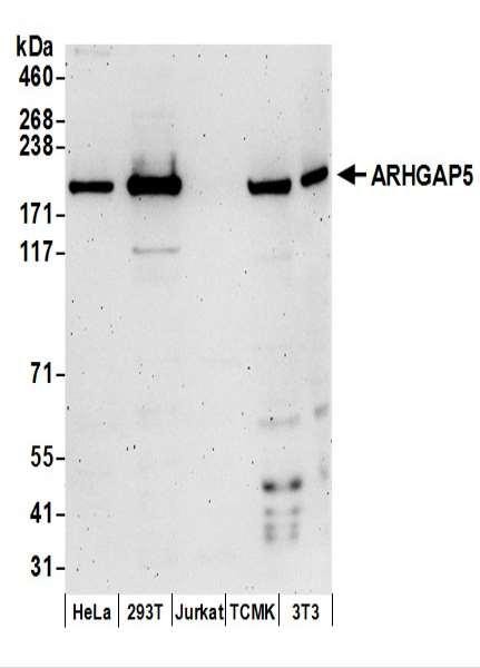 Anti-ARHGAP5