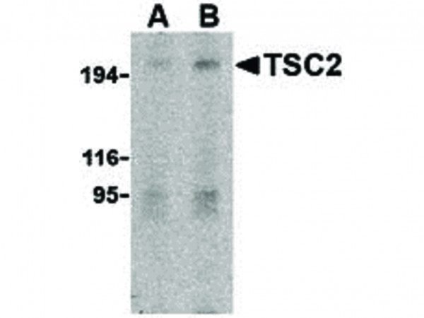 Anti-TSC2