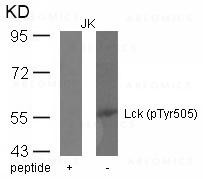 Anti-Lck (phospho-Tyr505)