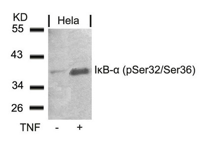 Anti-Phospho-NFKBIA (Ser32/Ser36)