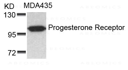 Anti-Progesterone Receptor (Ab-190)