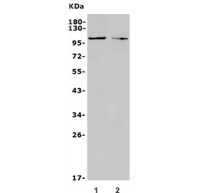 Anti-TRPC3