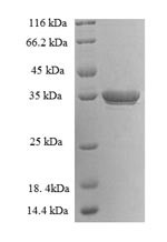 Lysine-specific demethylase 5A (KDM5A), human, recombinant