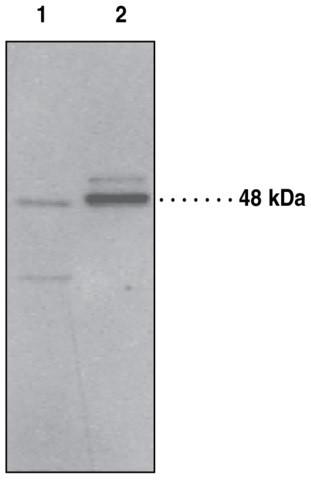 Anti-PAF receptor